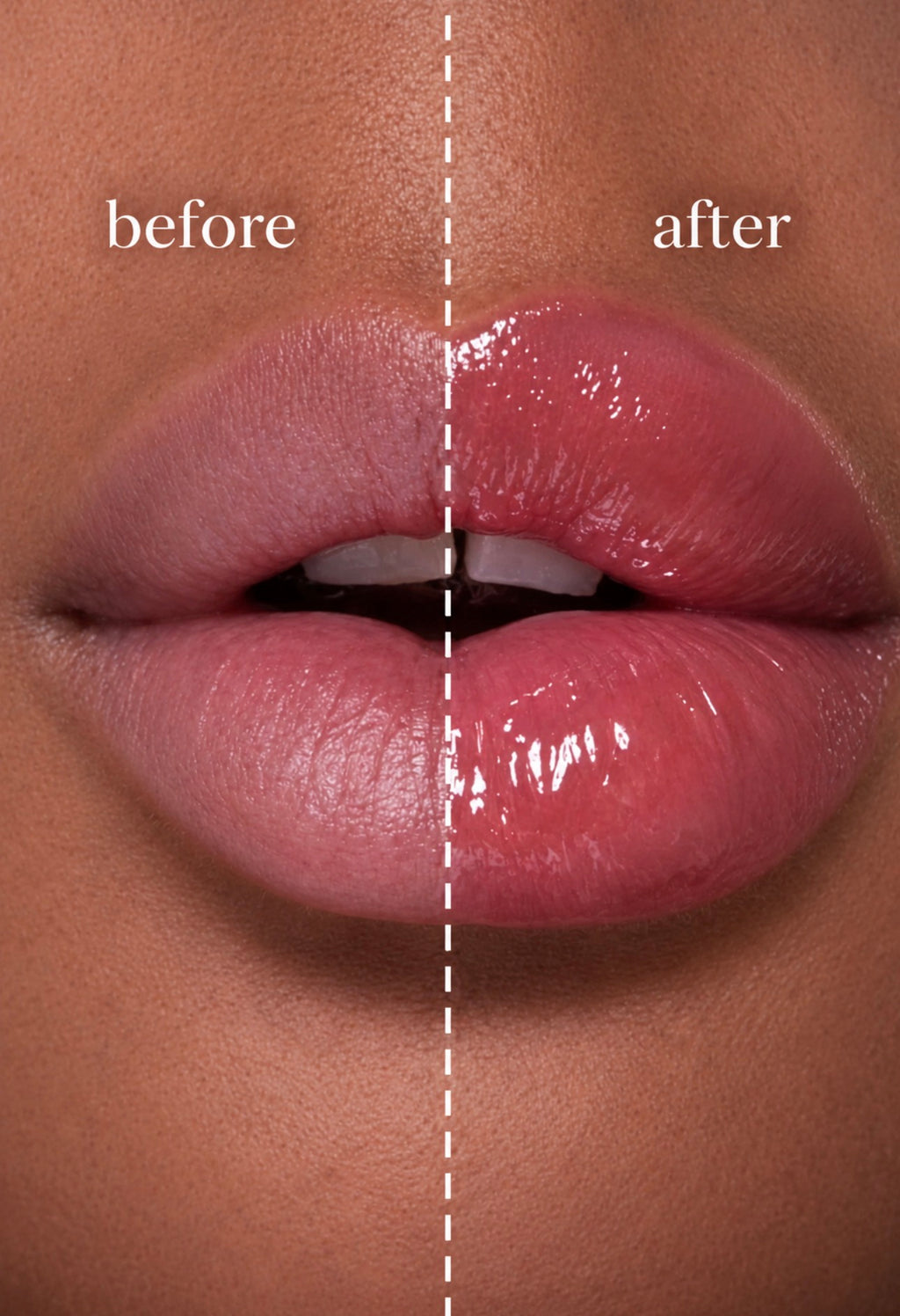LIP PLUMPER