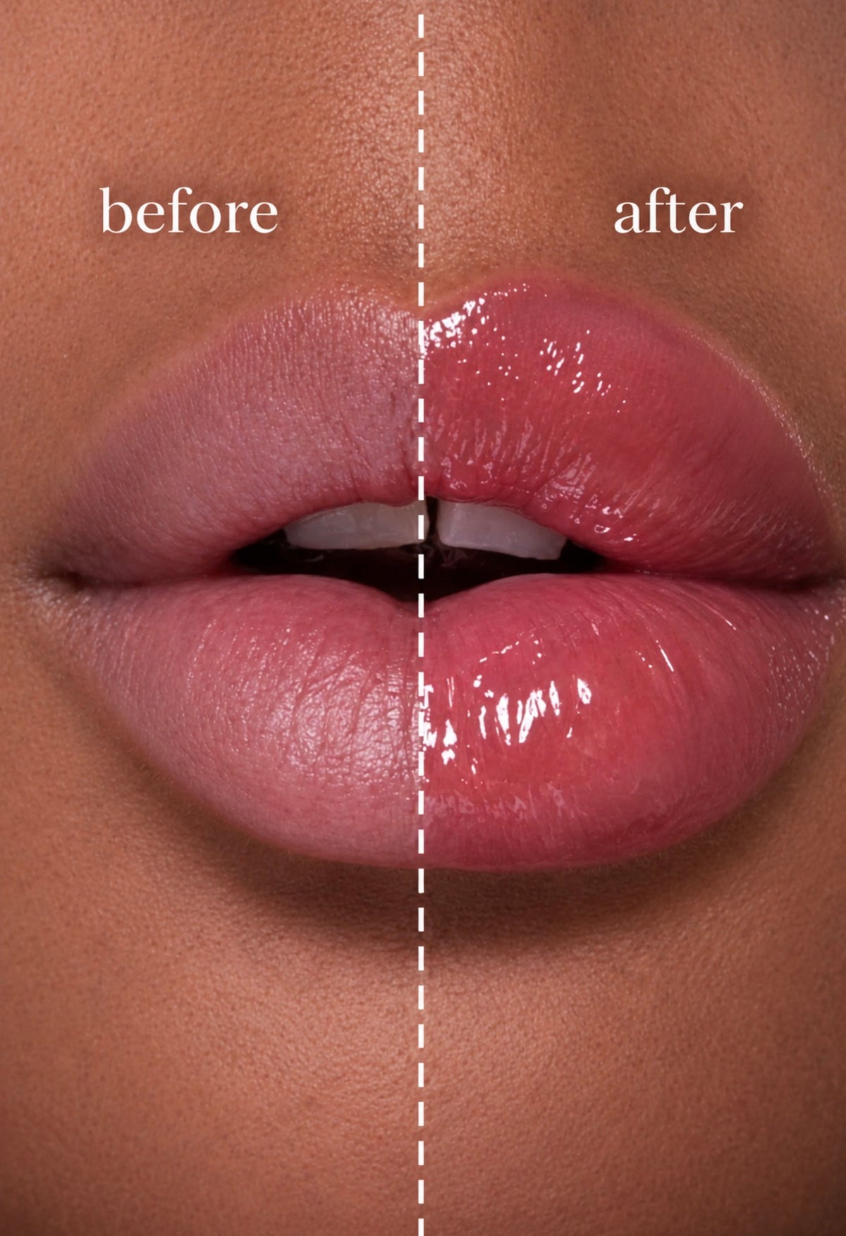 LIP PLUMPER