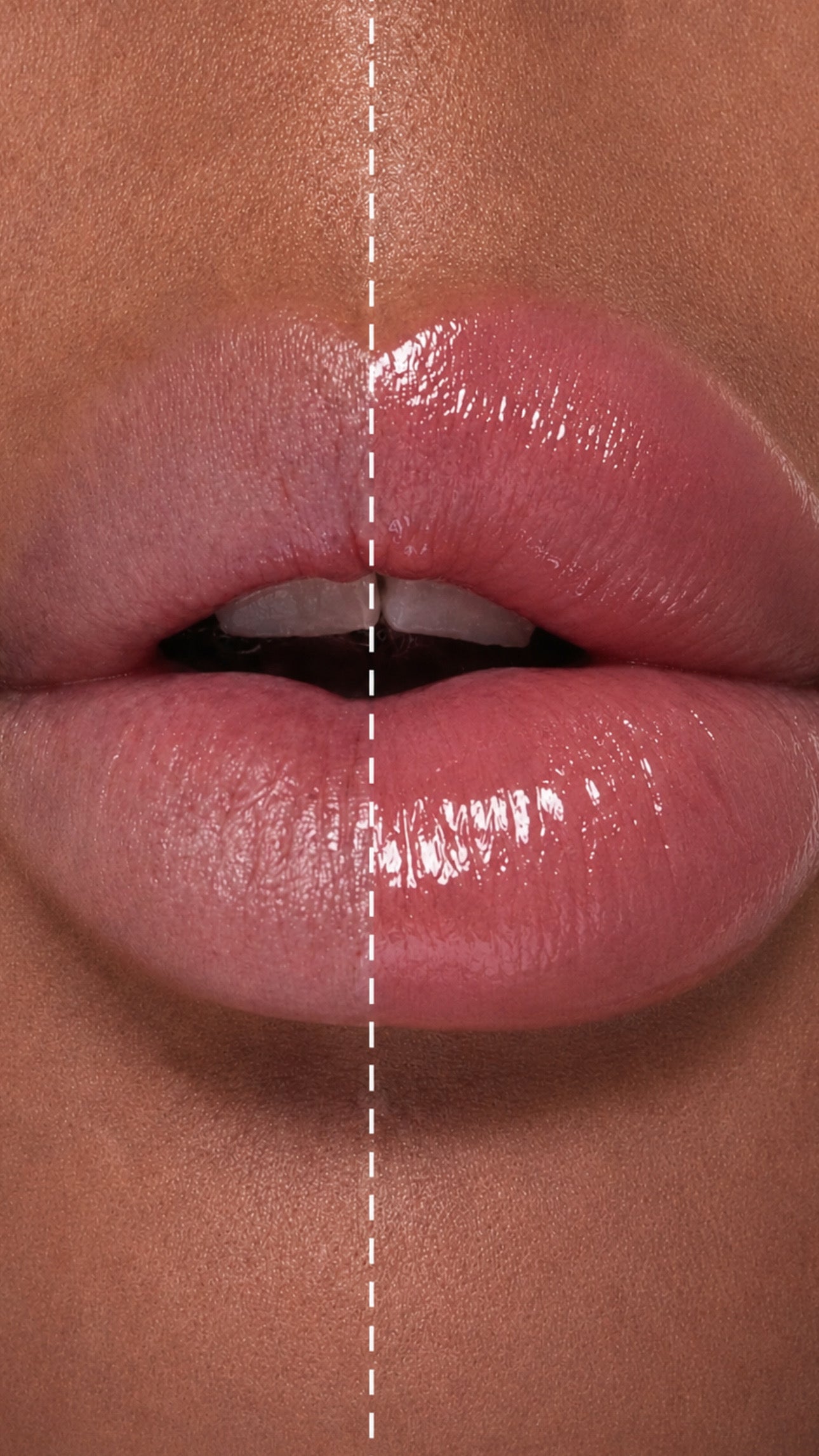 LIP PLUMPER