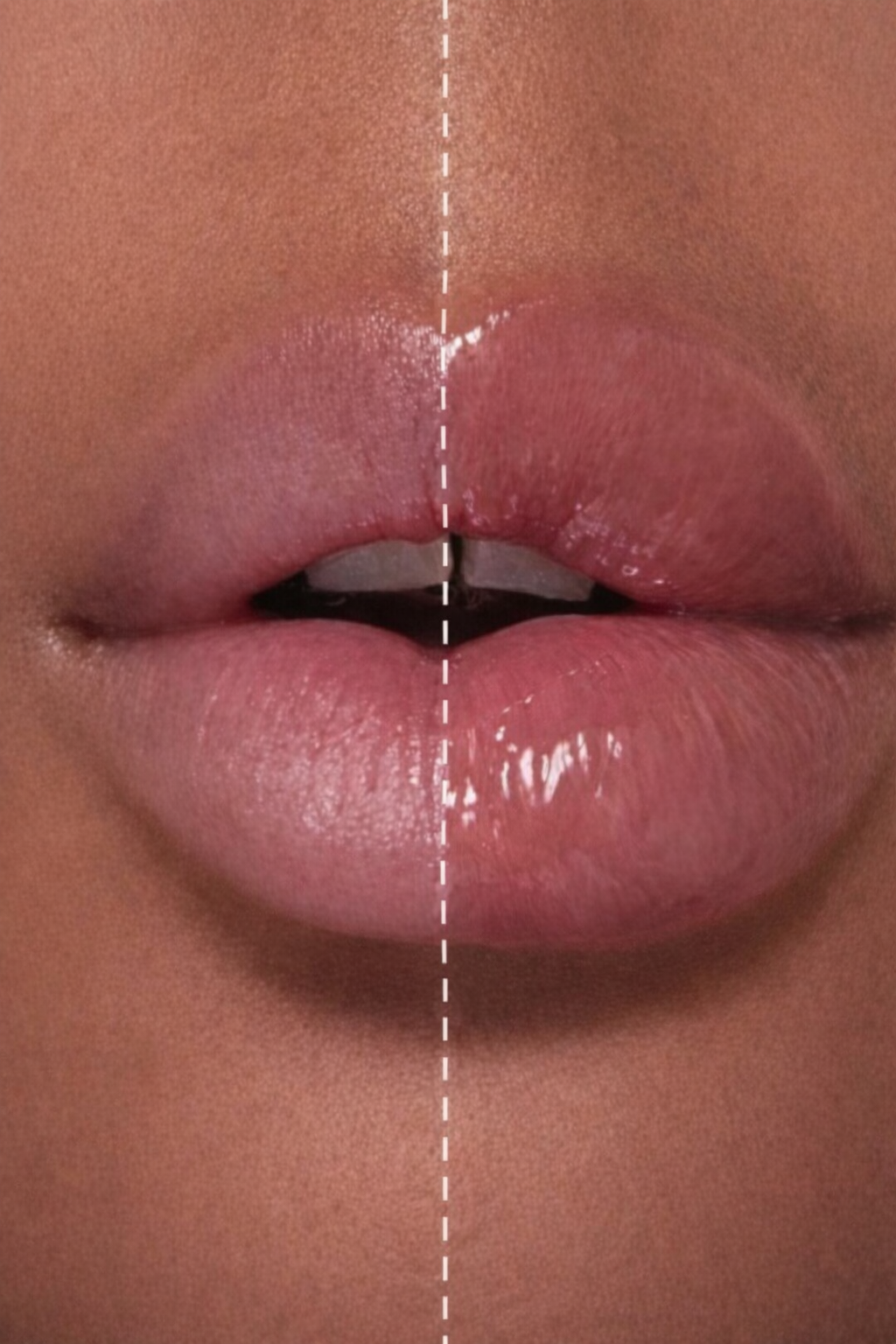 Extreme Lip Plumper